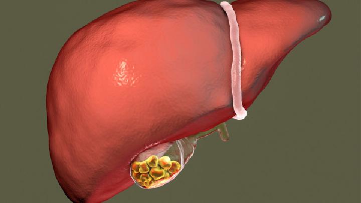 好好的为啥会患上胆结石呢？