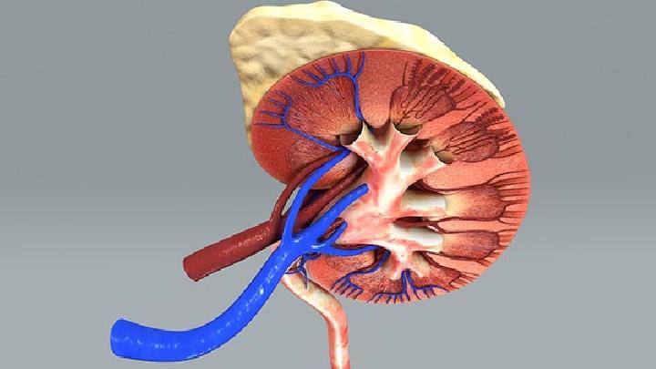 腹主动脉腔静脉瘘会引起哪些疾病？