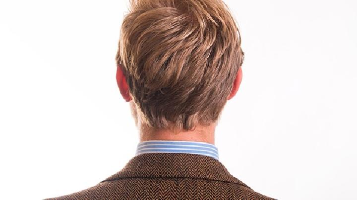 男子雄激素源性秃发有哪些症状