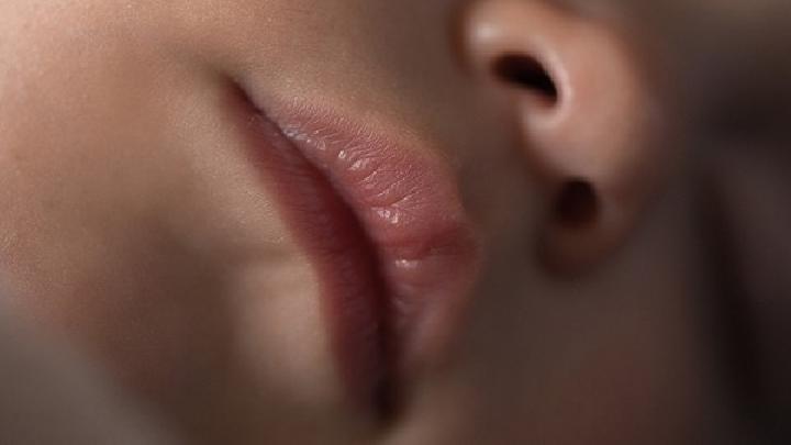 先天性重唇如何预防？