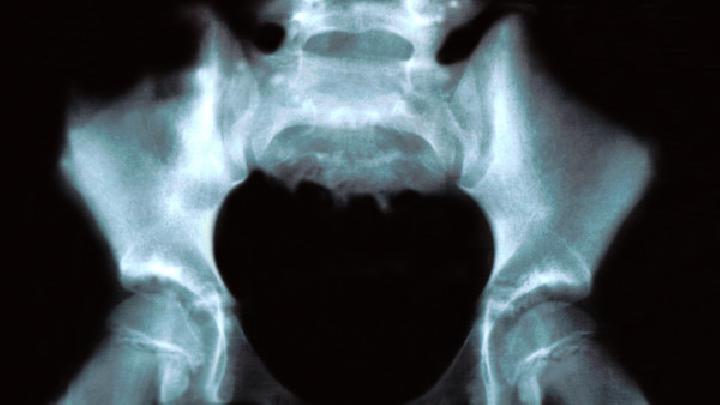 坐骨神经损伤吃什么好？