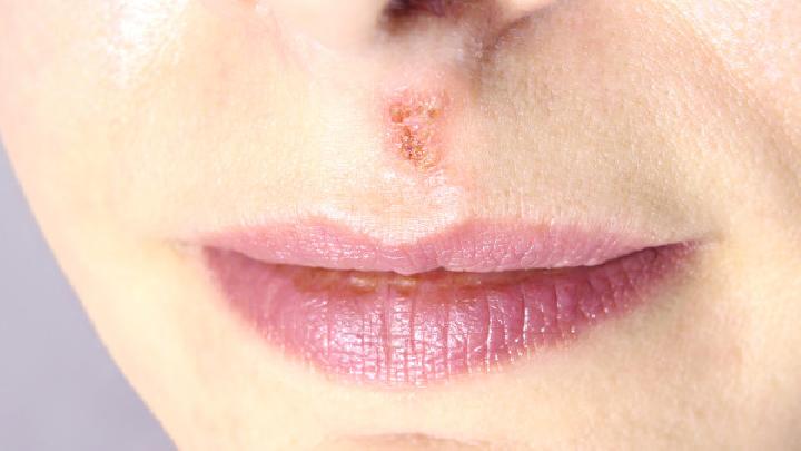 唇腭裂修复的五个阶段