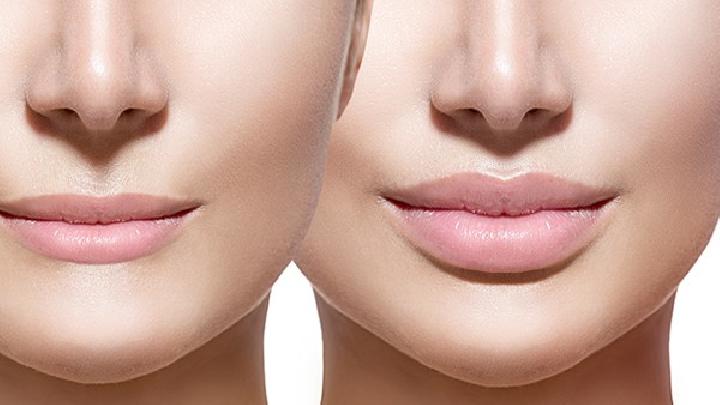 治疗唇裂的办法有哪些