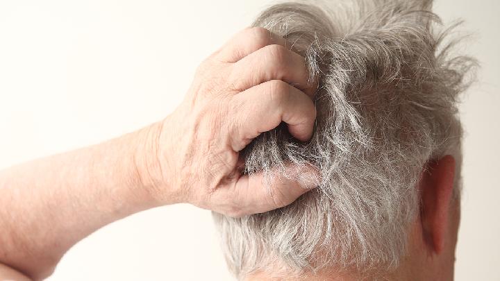 导致斑秃发病的原因有哪些？