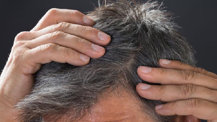 男性型秃发有哪些症状