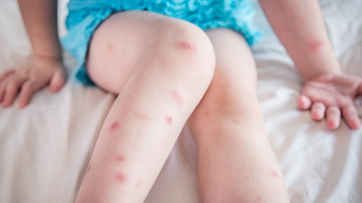 小孩子患上骨髓炎的发生原因是什么