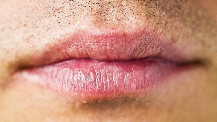 中医是怎么治过敏性唇炎