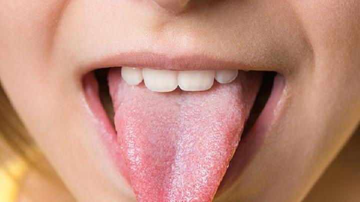 舌系带过短常见的就诊原因及诊断
