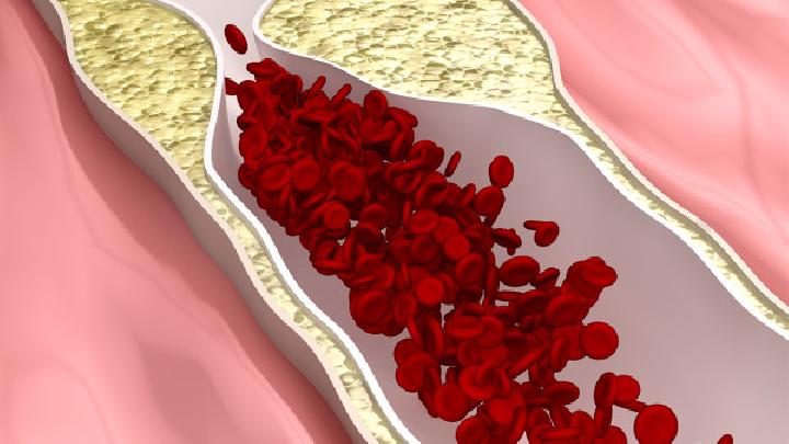 血管炎吃哪些食物对身体有益呢