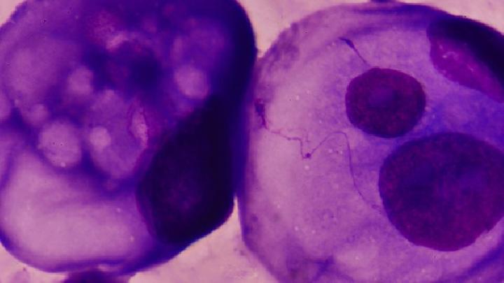 如何治疗先天性梅毒患者