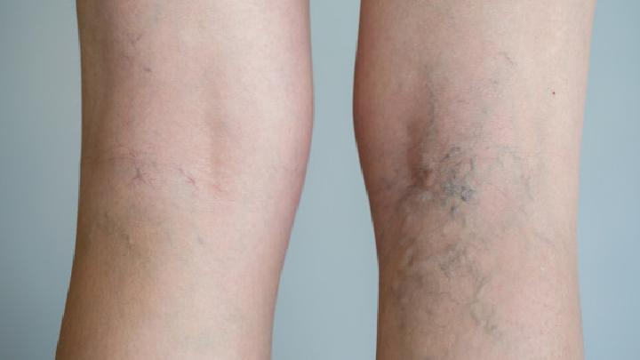 骨癌患者在术后要如何护理