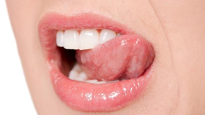唇炎患者日常该如何护理