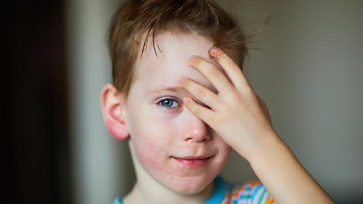 小儿突发急性荨麻疹需要注意什么