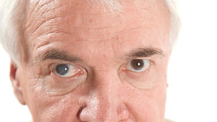 眼睛黄斑水肿怎么治疗好的快3个眼部黄斑水肿的症状也要知道