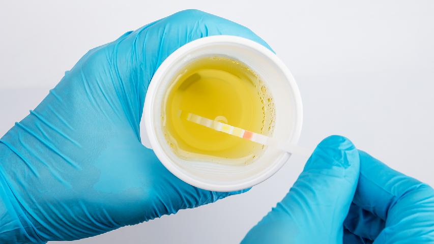 新冠无症状感染者真的一点症状都没有吗 新冠无症状感染者没有症状需要治疗吗