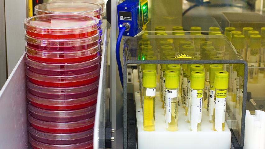 核酸一直檢測中需要再做一次嗎核酸檢測中多久顯示檢測記錄