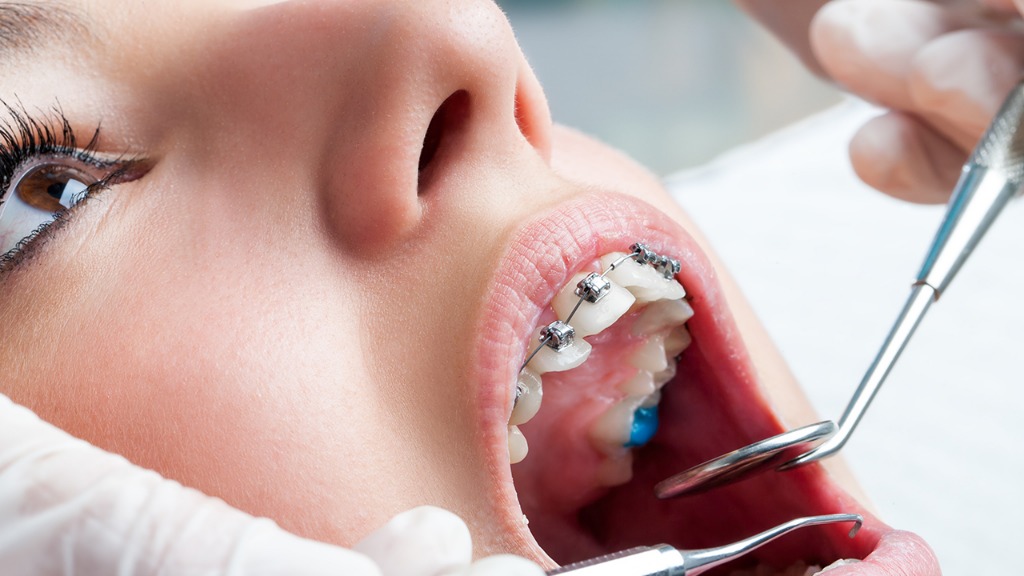 磨牙的危害都有哪些 导致磨牙的因素都有哪些