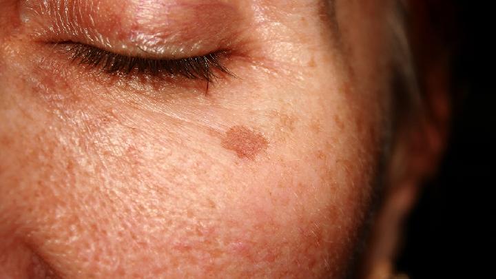 有哪些皮肤护理的小技巧六个护肤技巧让皮肤变得健康又水嫩