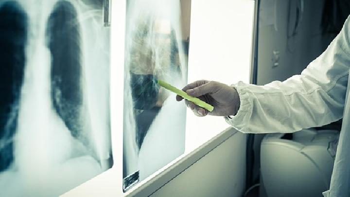 朗格汉斯组织细胞增多症该怎么去治疗