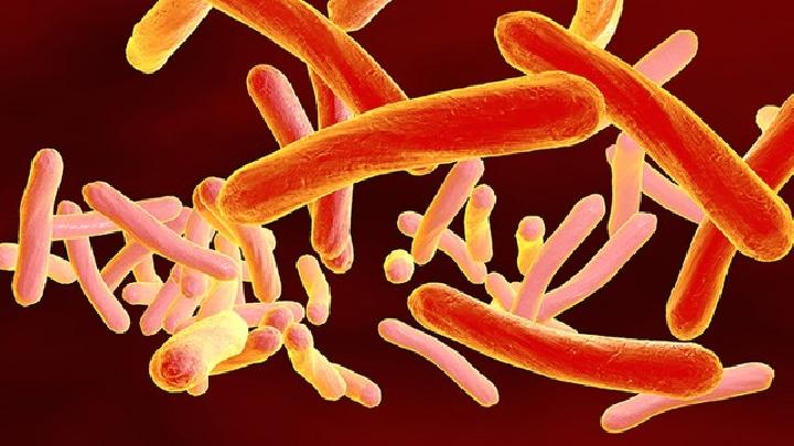 B链球菌群感染是由什么原因引起的？
