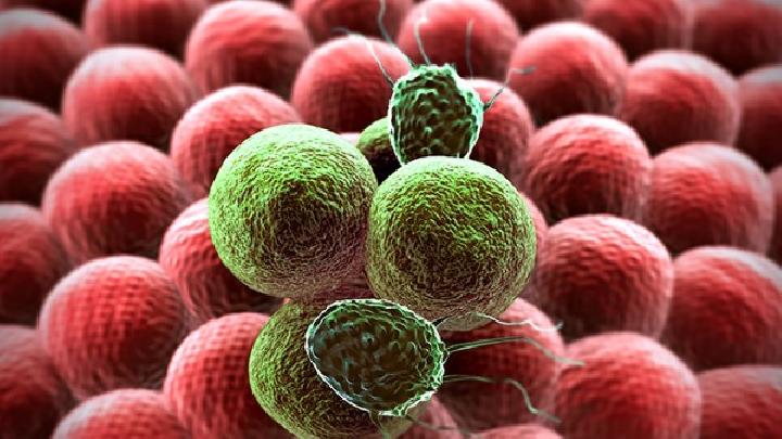 中间型链球菌感染应该如何预防？