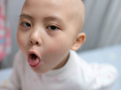 婴儿白血病治疗的方法是什么 如何预防白血病