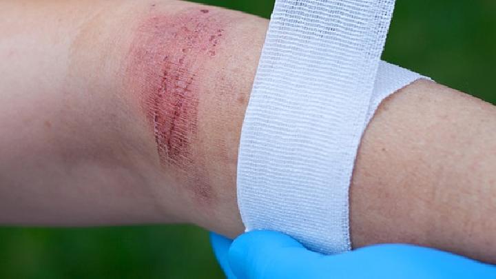 女性要怎样预防滴虫病