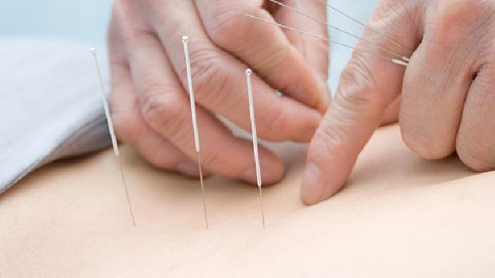 脓疱性痤疮的中医针灸治疗
