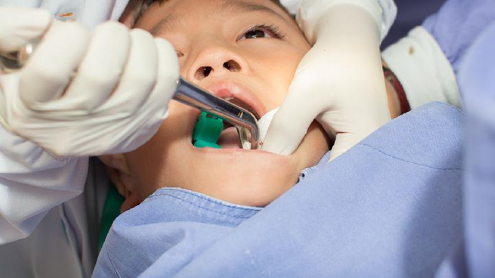 西医治疗牙髓变性的常规方法