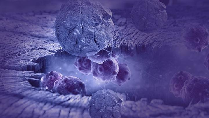 鳞状细胞癌易导致什么并发症 