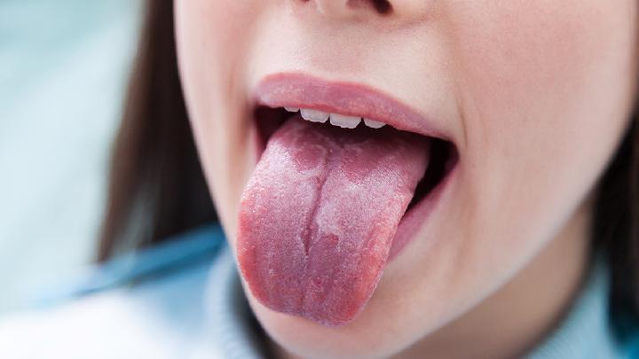 舌头溃疡有哪些典型症状