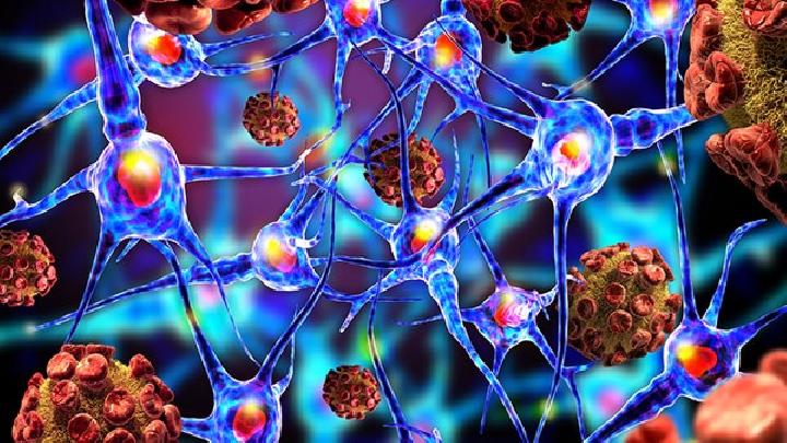 球孢子菌病应该做哪些检查？