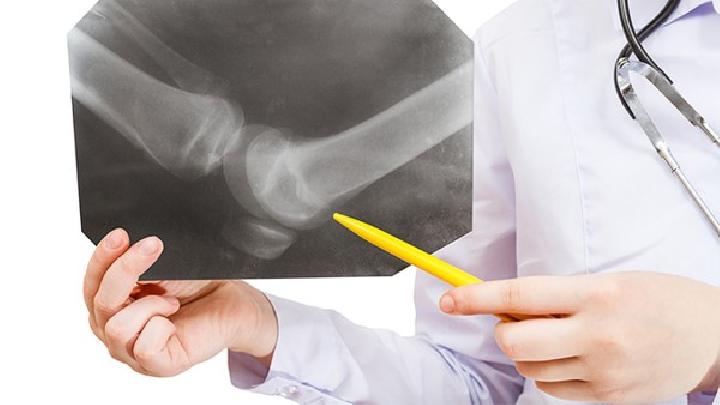 纤维性骨炎是怎么引起的？