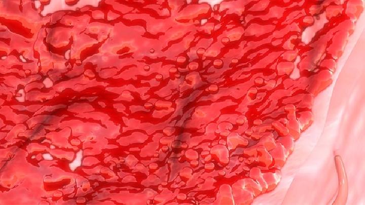 纯红细胞再生障碍性贫血