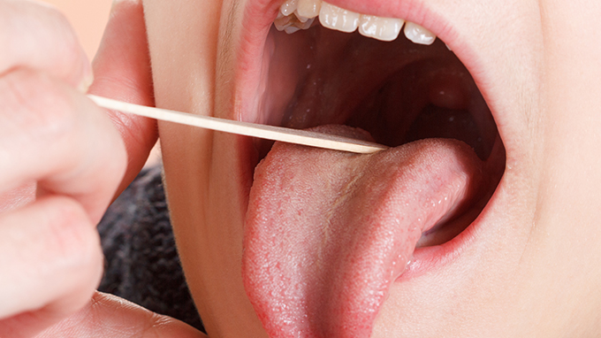 舌苔黄腻是什么原因