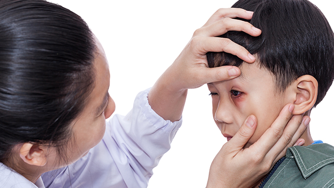 儿童脑胶质瘤对视力的损害