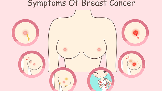 成功促进母乳喂养十项措施