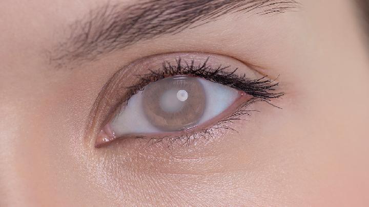 5种人群最容易有黑眼圈 造成黑眼圈的6个原因也要知道