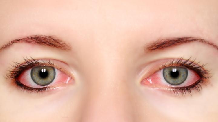 糖尿病眼睛并发症分几期4个糖尿病眼睛并发症的病变预防措施