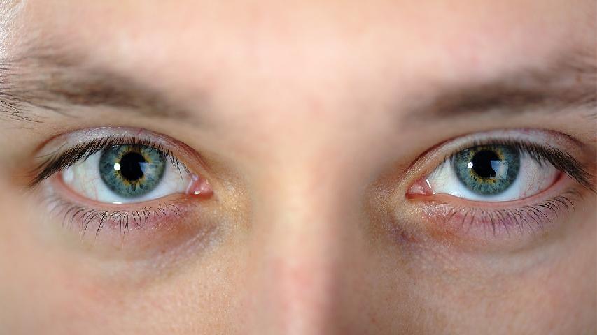 黑眼圈形成的5大因素须知 消除黑眼圈可用这些方法