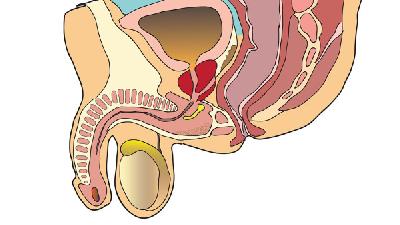 几大原因困扰前列腺疾病的治疗 有效预防前列腺炎的两个方法