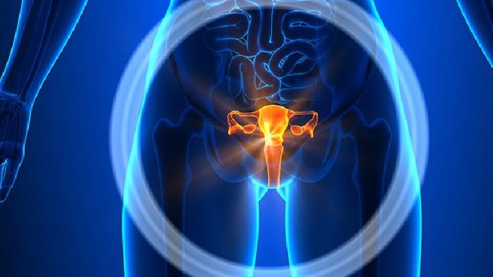 宫颈息肉会引发子宫颈癌吗预防宫颈癌需理清这3个误区
