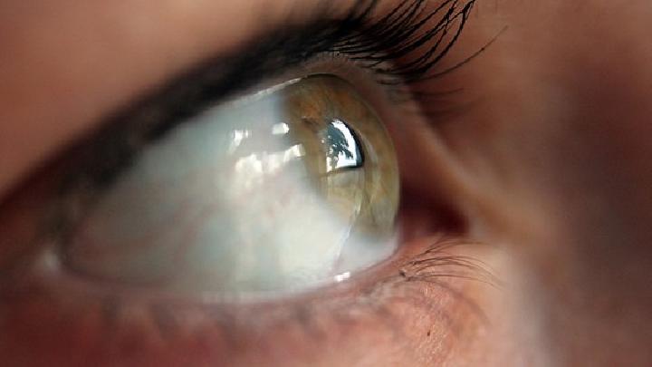 青光眼该如何检查青光眼和眼压有什么联系