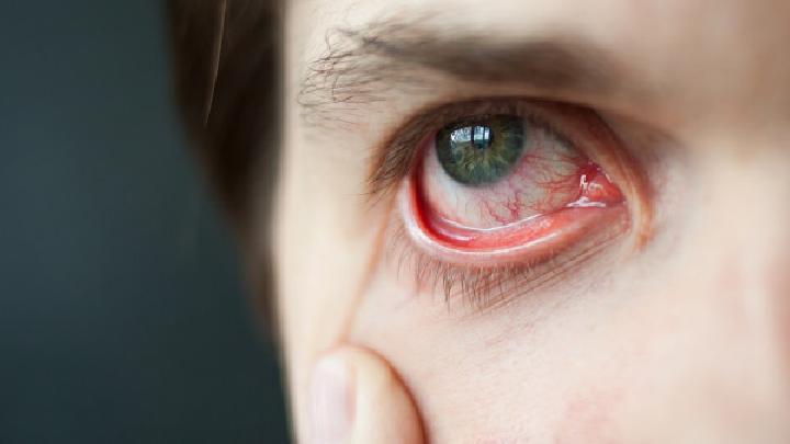 青光眼的早期症状早晨不能看书也是青光眼的症状吗