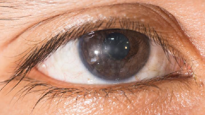 青光眼患者怎么进行抗过敏治疗有青光眼的患者抗过敏治疗要小心