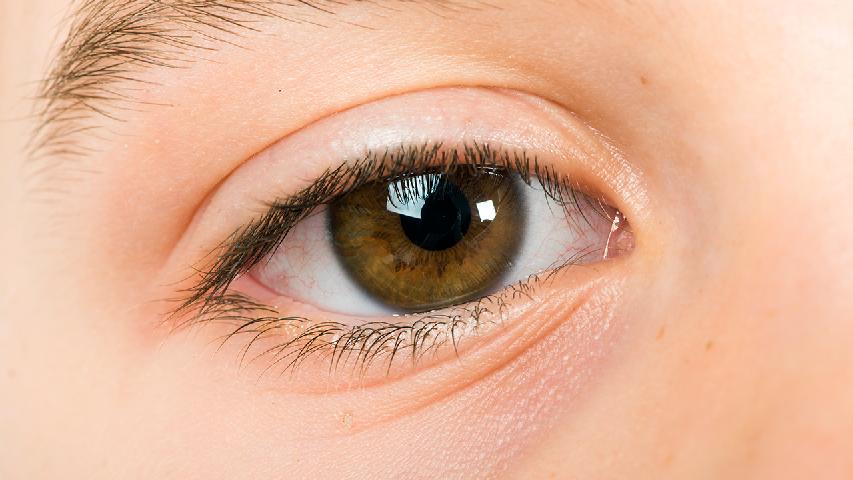 轻微青光眼什么症状 轻微青光眼有4个表现