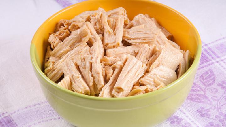 经常上火吃什么食物去火 爱上火的人可常吃这些食物