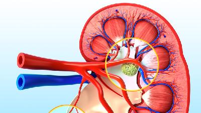 腎虛的癥狀是什么 男性腎虛可以吃這3種食物