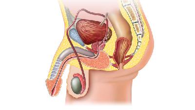 包皮过长引起早泄是怎么回事？包皮过长手术注意事项