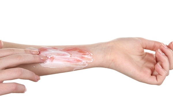 秀碧除疤膏能消除哪些疤痕？能不能祛痘印呢？